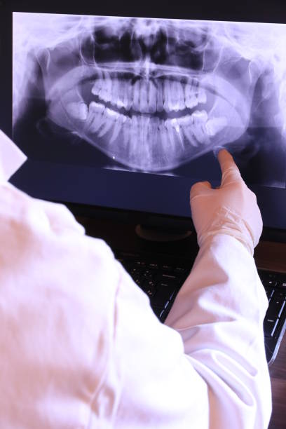Best Dentist for Tooth Abscess  in Myrtle Grove, FL