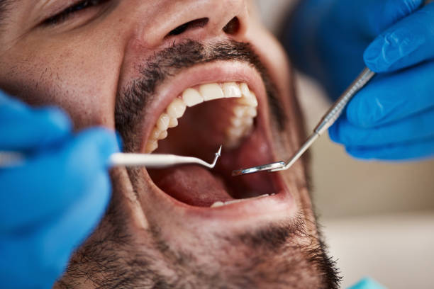 Best Emergency Gum Pain Relief  in Myrtle Grove, FL